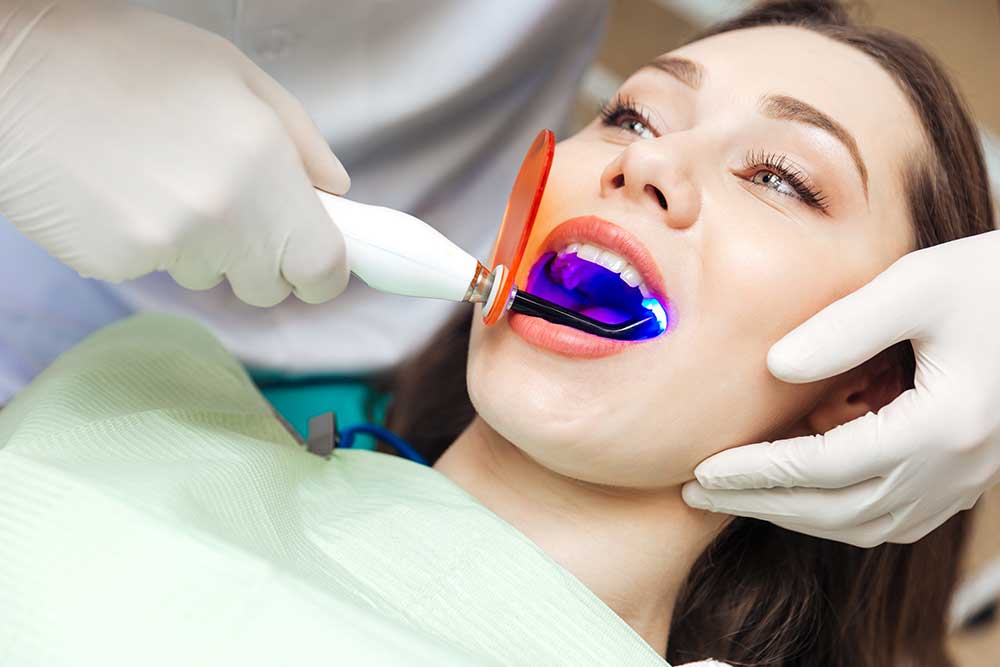 composite-fillings-dentist-in-katy-tx composite fillings dentist