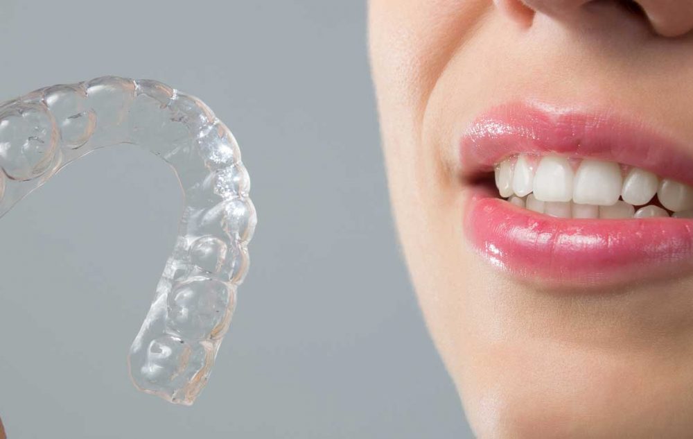 invisalign dentist