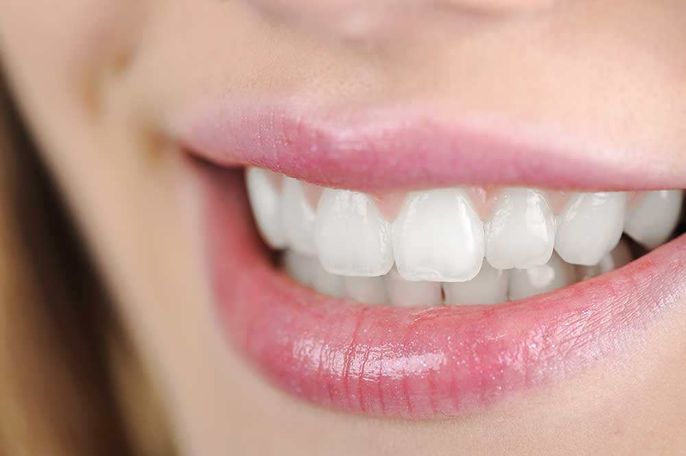 teeth whitening near me